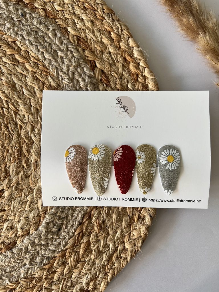 Ontdek het betoverende Setje haarspeldjes Loua met elegante bloemenprint en schitterende glitteraccenten, verkrijgbaar in verschillende maten